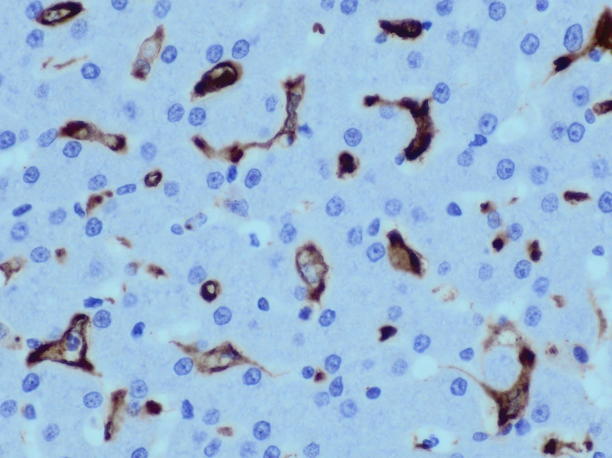 AIF-1/Iba1 Antibody NB100-1028