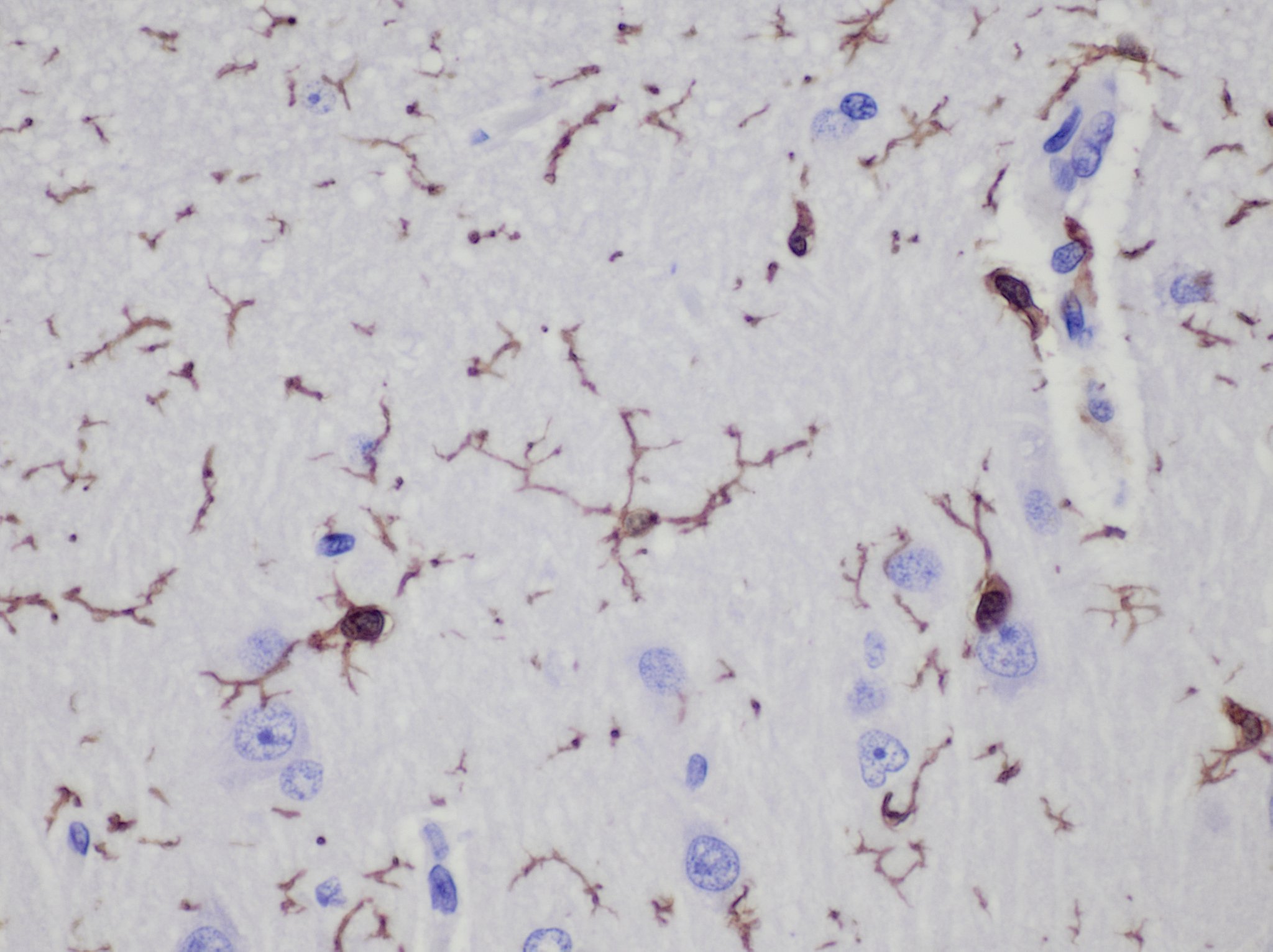 AIF-1/Iba1 Antibody NB100-1028