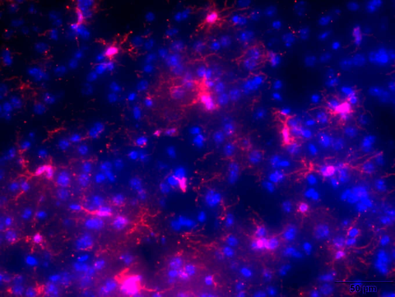 AIF-1/Iba1 Antibody NB100-1028