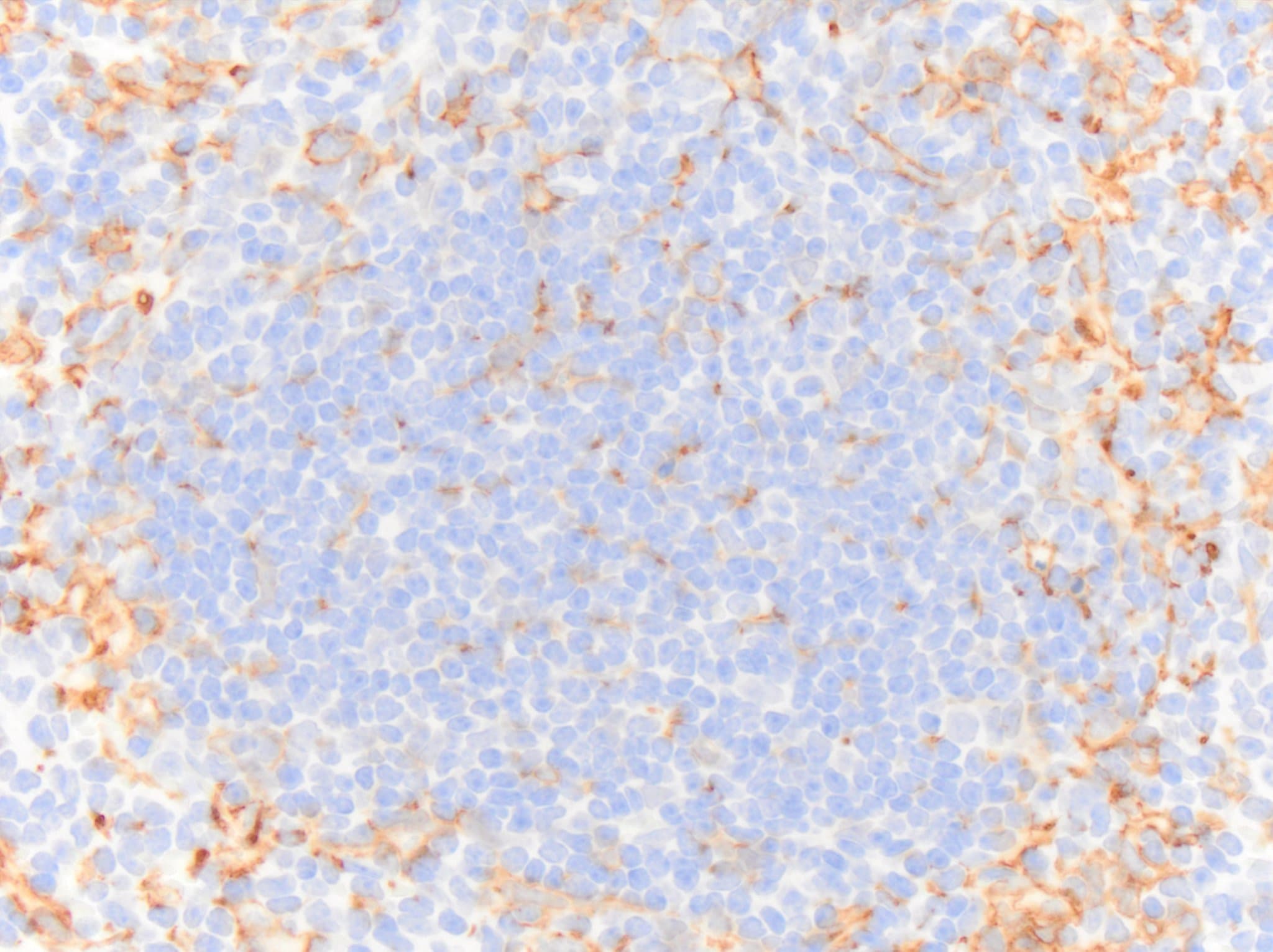 AIF-1/Iba1 Antibody NB100-1028