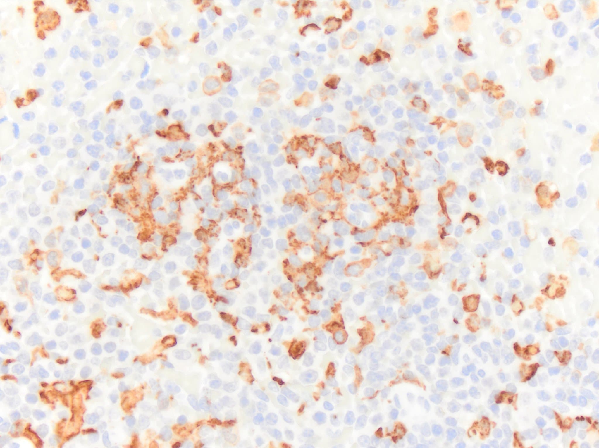 AIF-1/Iba1 Antibody NB100-1028