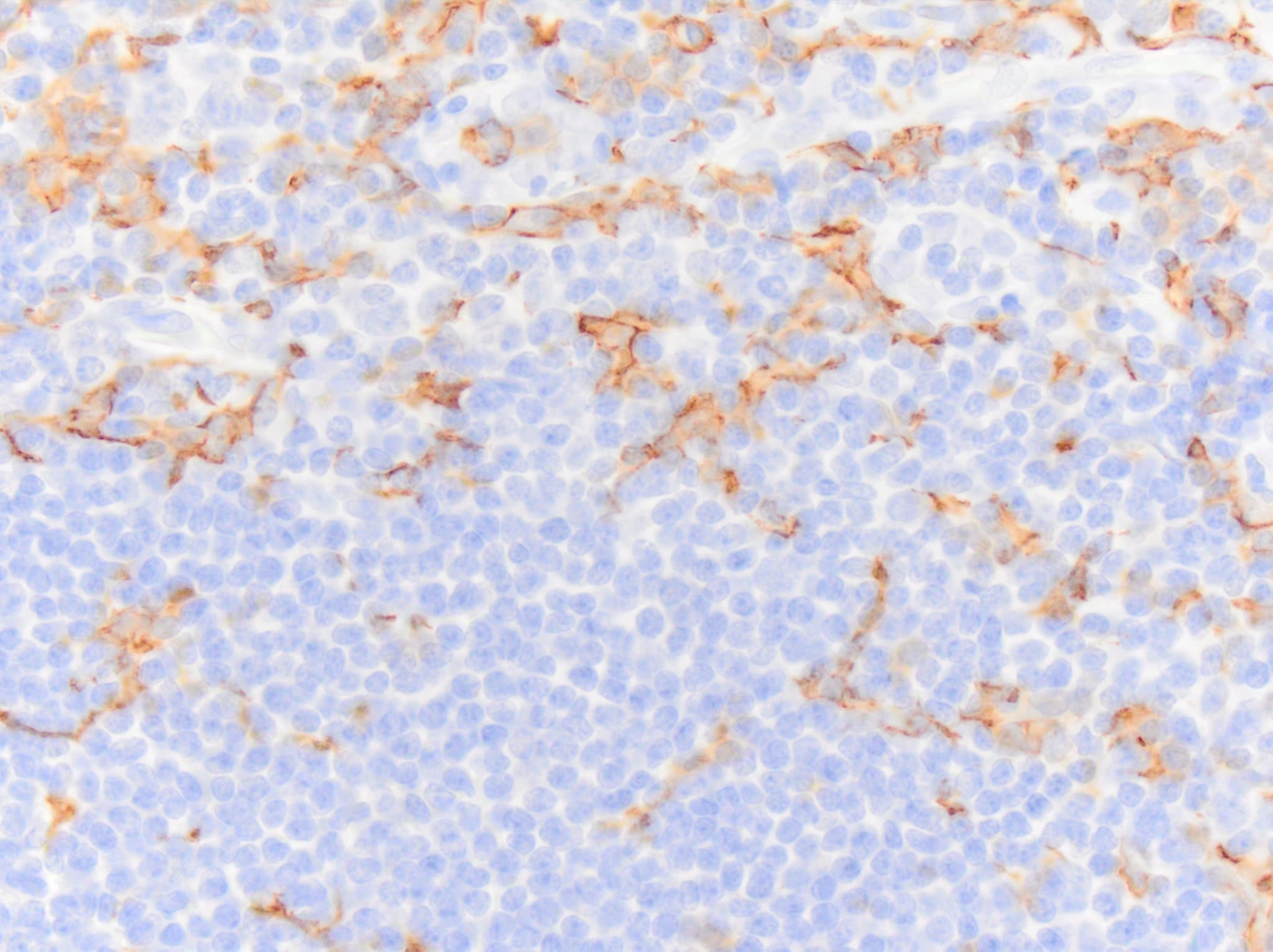 AIF-1/Iba1 Antibody NB100-1028