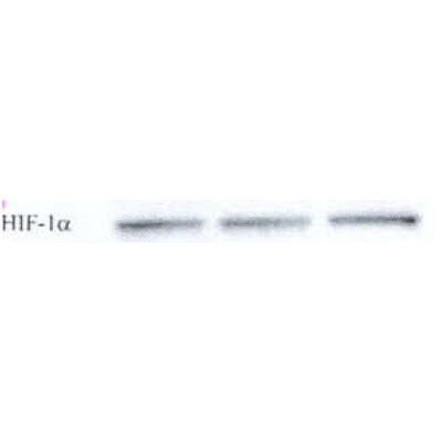 HIF-1 alpha Antibody (H1alpha67) NB100-105