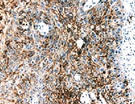 HIF-1 alpha Antibody (H1alpha67) NB100-105