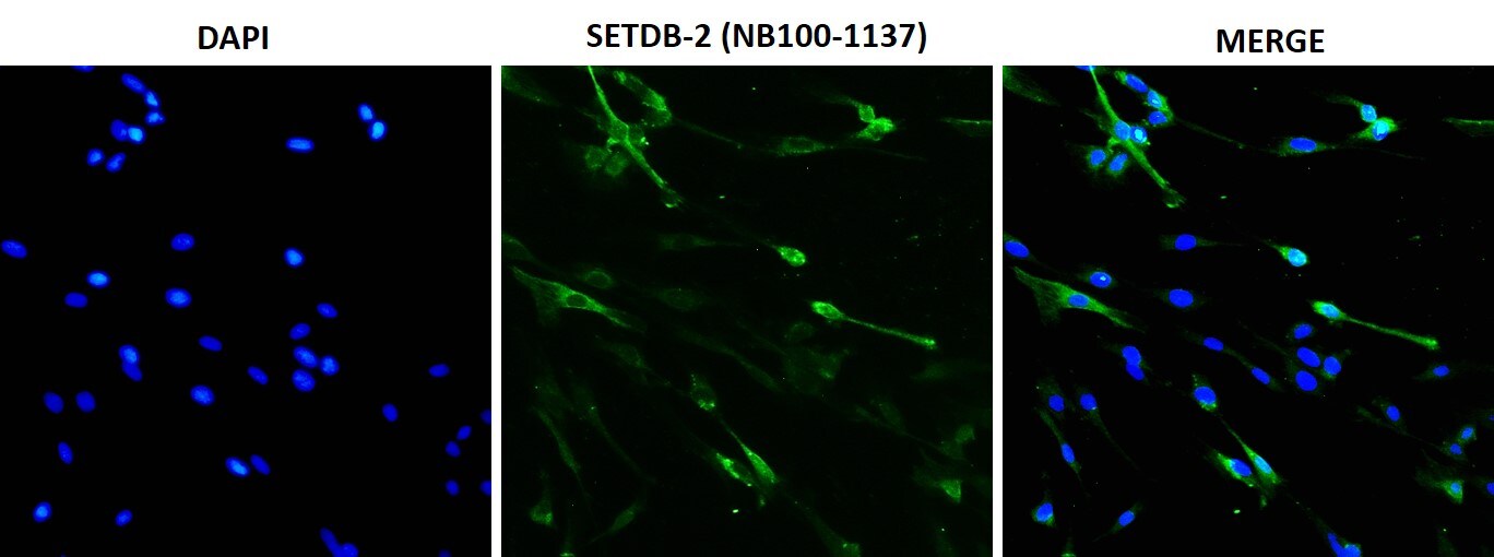 SETDB2 Antibody NB100-1137