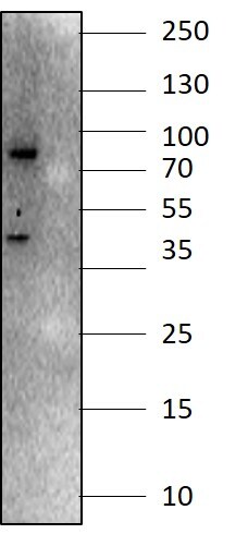 SETDB2 Antibody NB100-1137