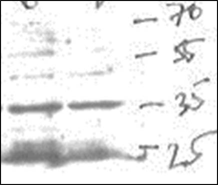 SUV39H2 Antibody NB100-1140