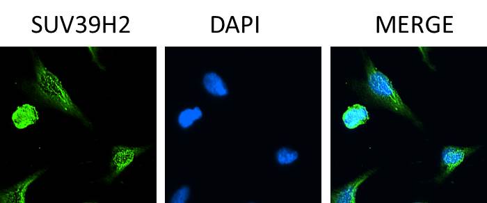 SUV39H2 Antibody NB100-1140