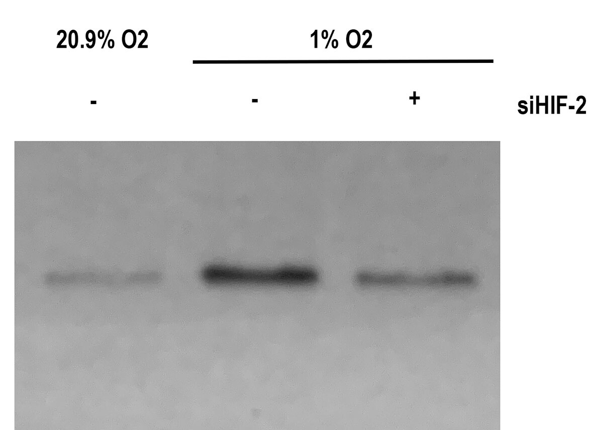 HIF-2 alpha/EPAS1 Antibody (ep190b) NB100-132