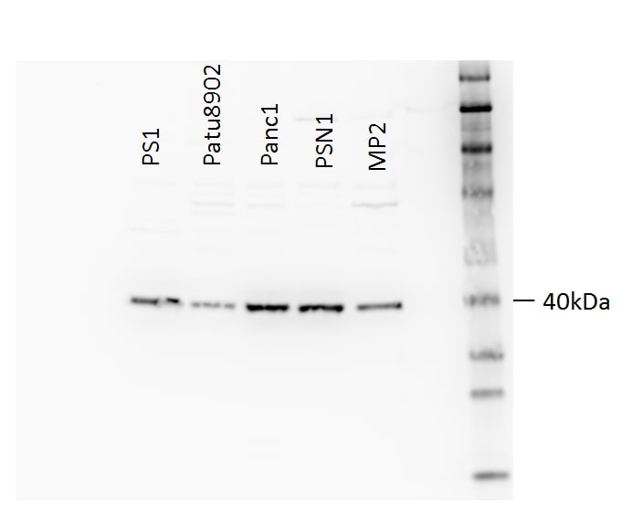 EGLN1/PHD2 Antibody - BSA Free NB100-137