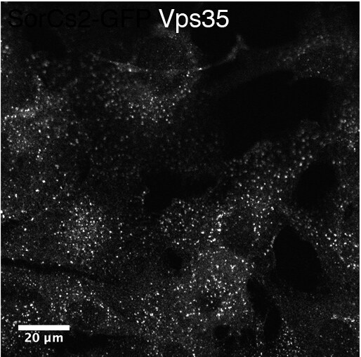 VPS35 Antibody NB100-1397