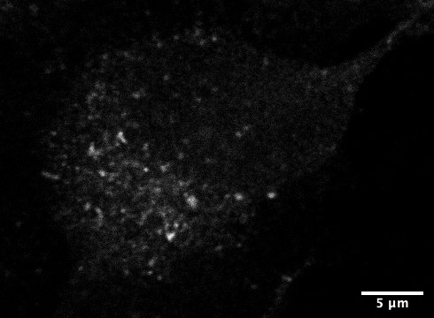 VPS35 Antibody NB100-1397
