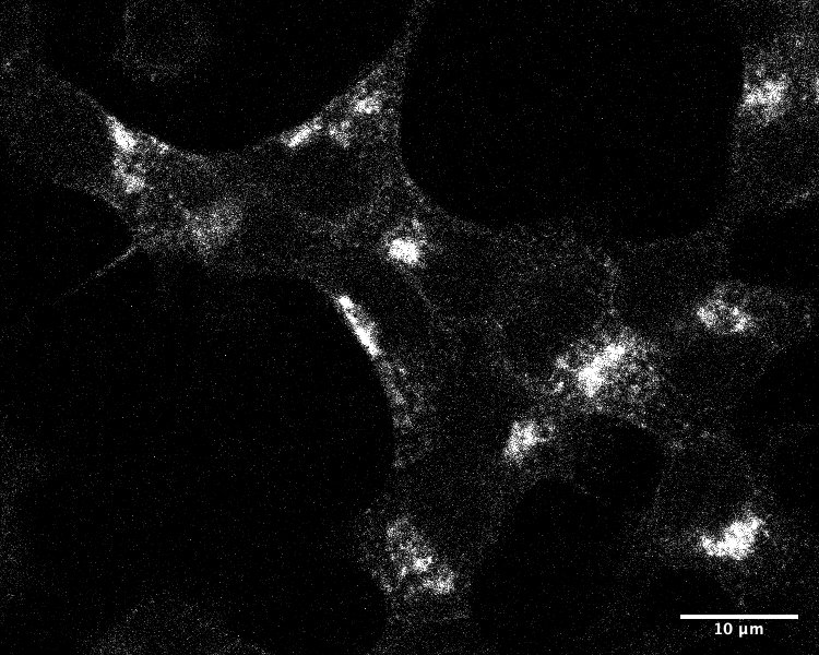 VPS35 Antibody NB100-1397