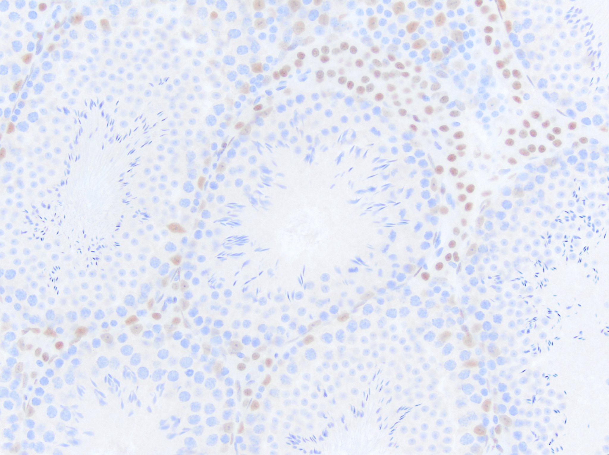 Androgen R/NR3C4 Antibody NB100-1446