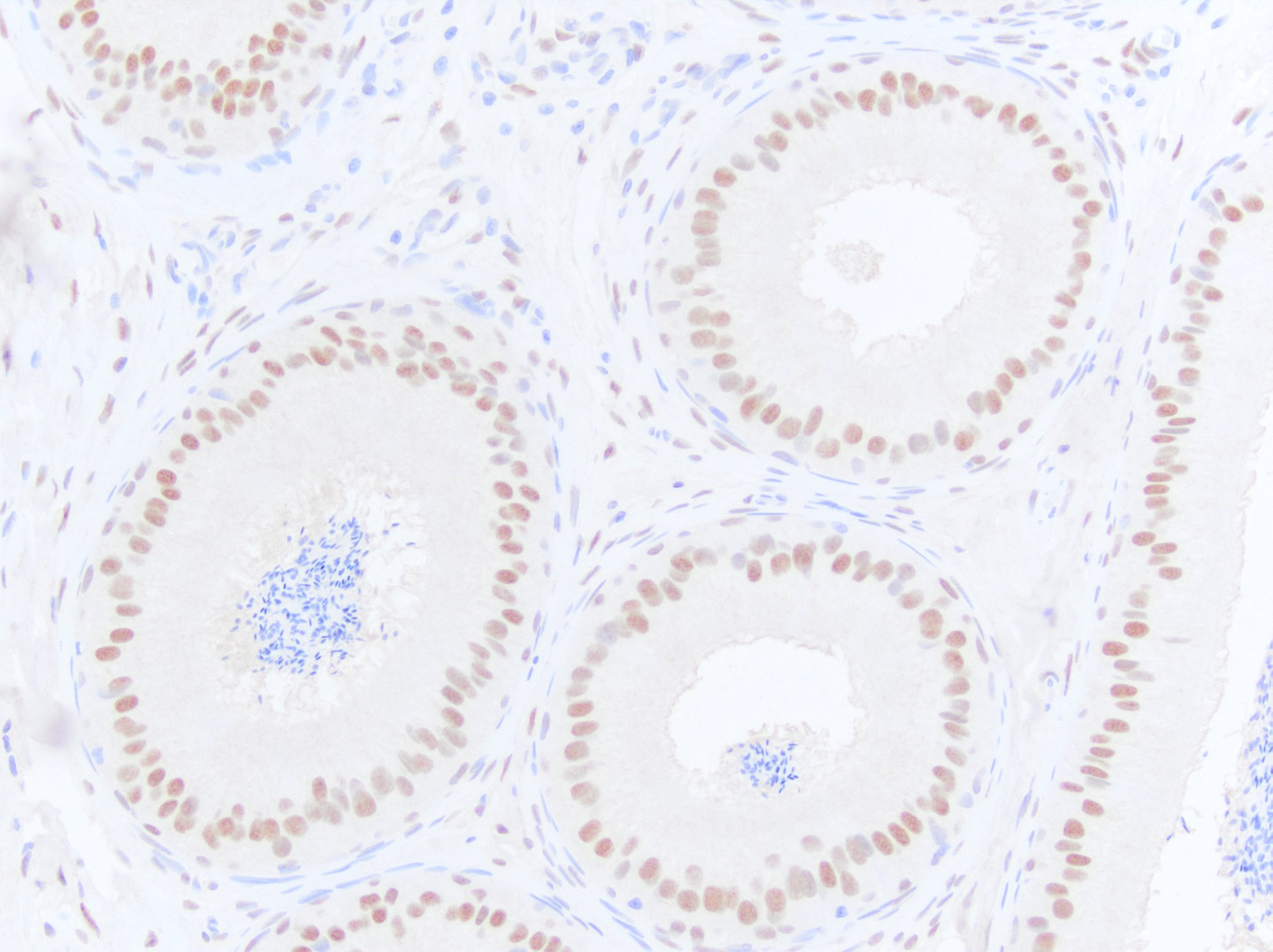 Androgen R/NR3C4 Antibody NB100-1446