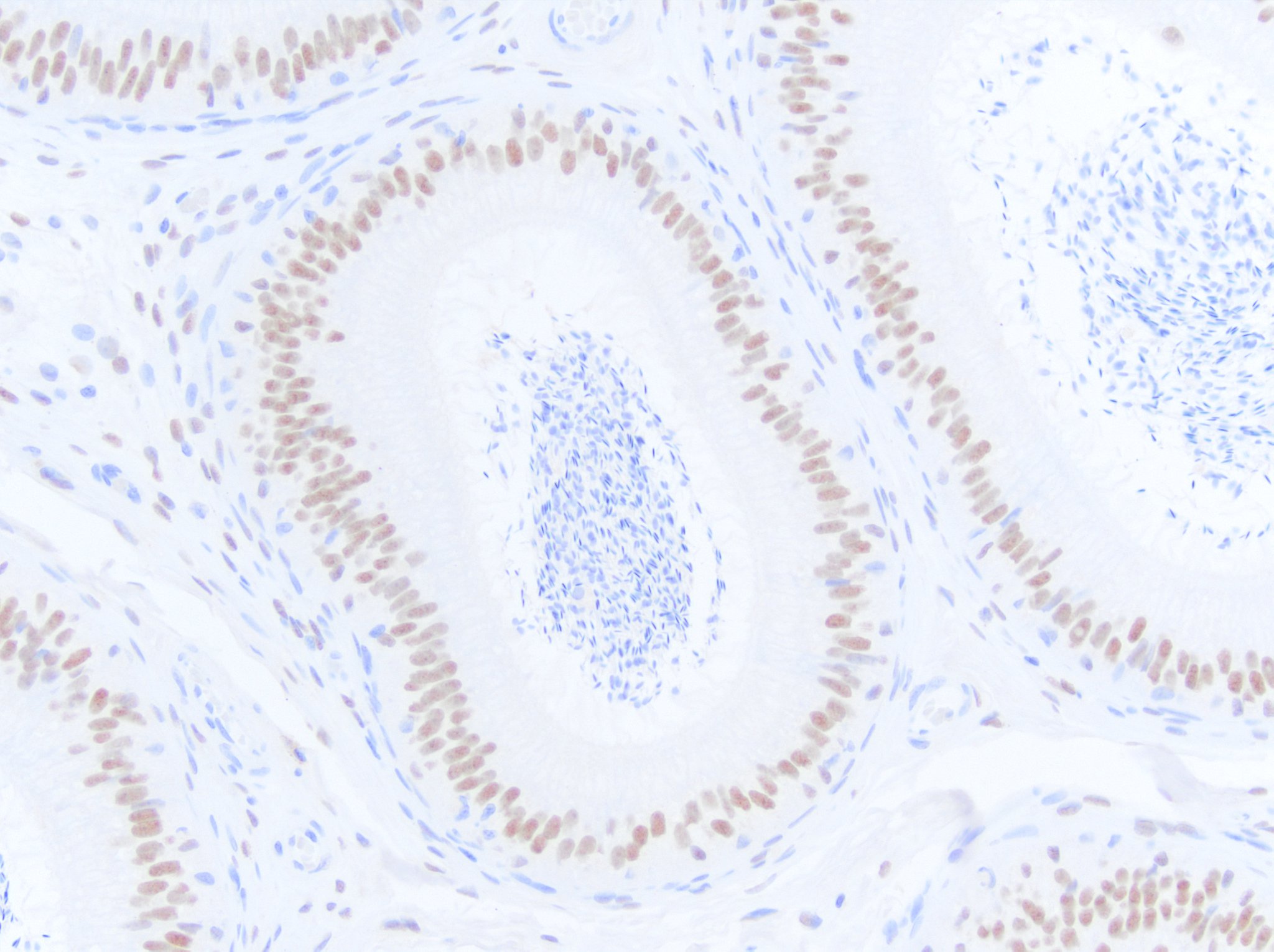 Androgen R/NR3C4 Antibody NB100-1446