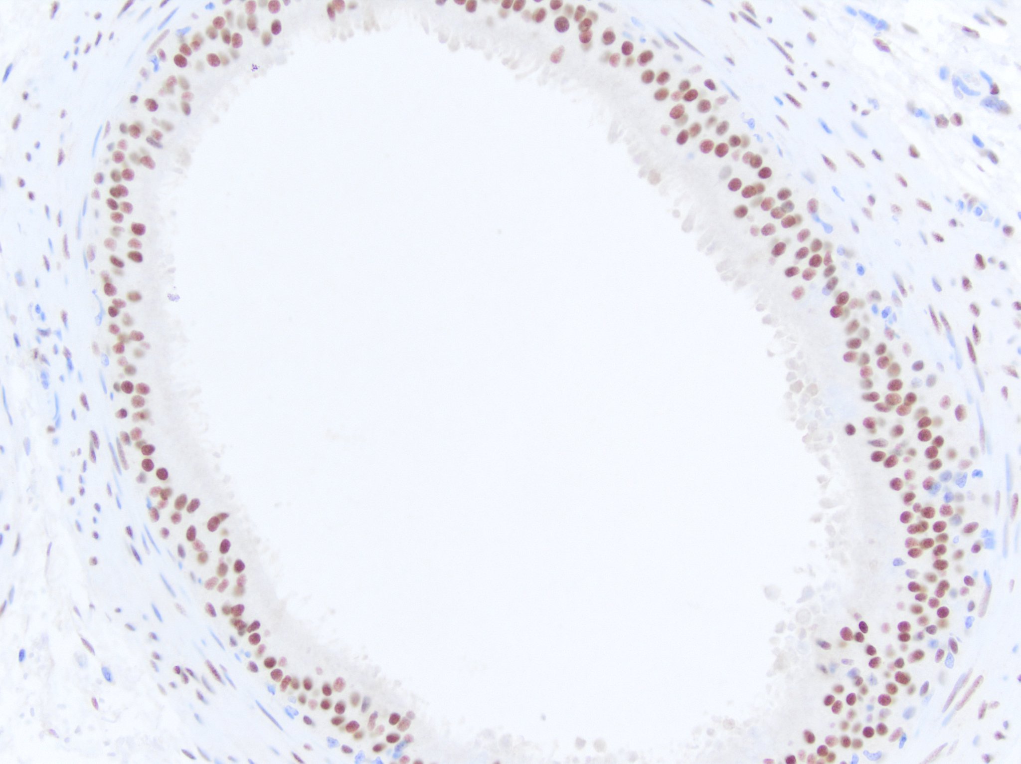 Androgen R/NR3C4 Antibody NB100-1446