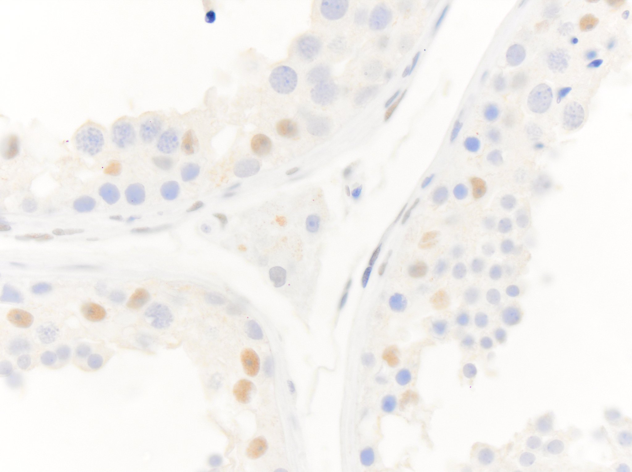 Androgen R/NR3C4 Antibody NB100-1446