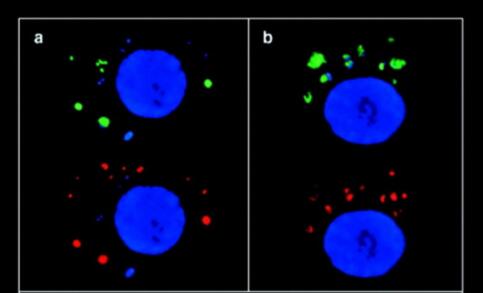 Rad51 Antibody (14B4) - Azide and BSA Free NB100-148