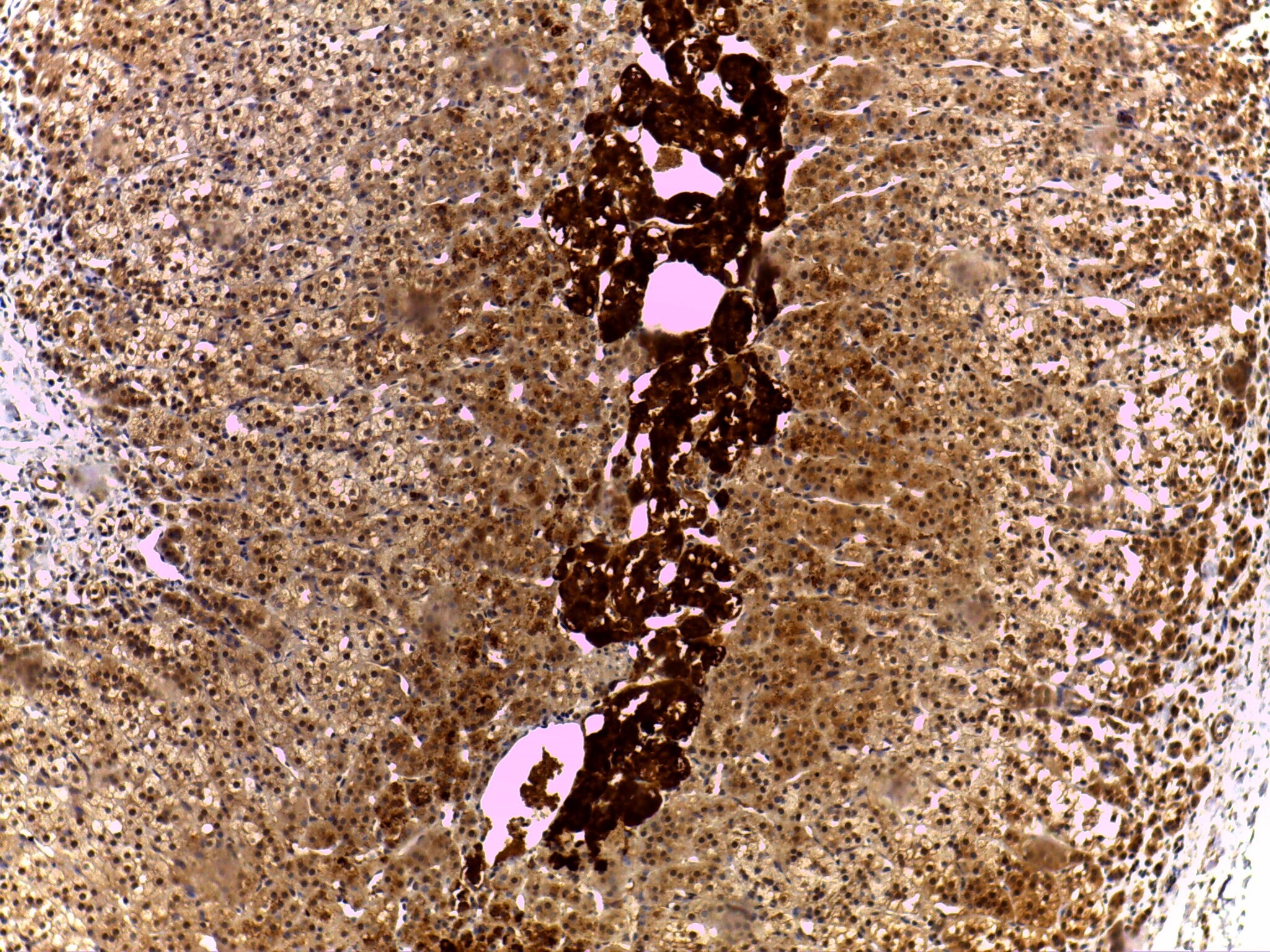 SRD5A1 Antibody NB100-1491
