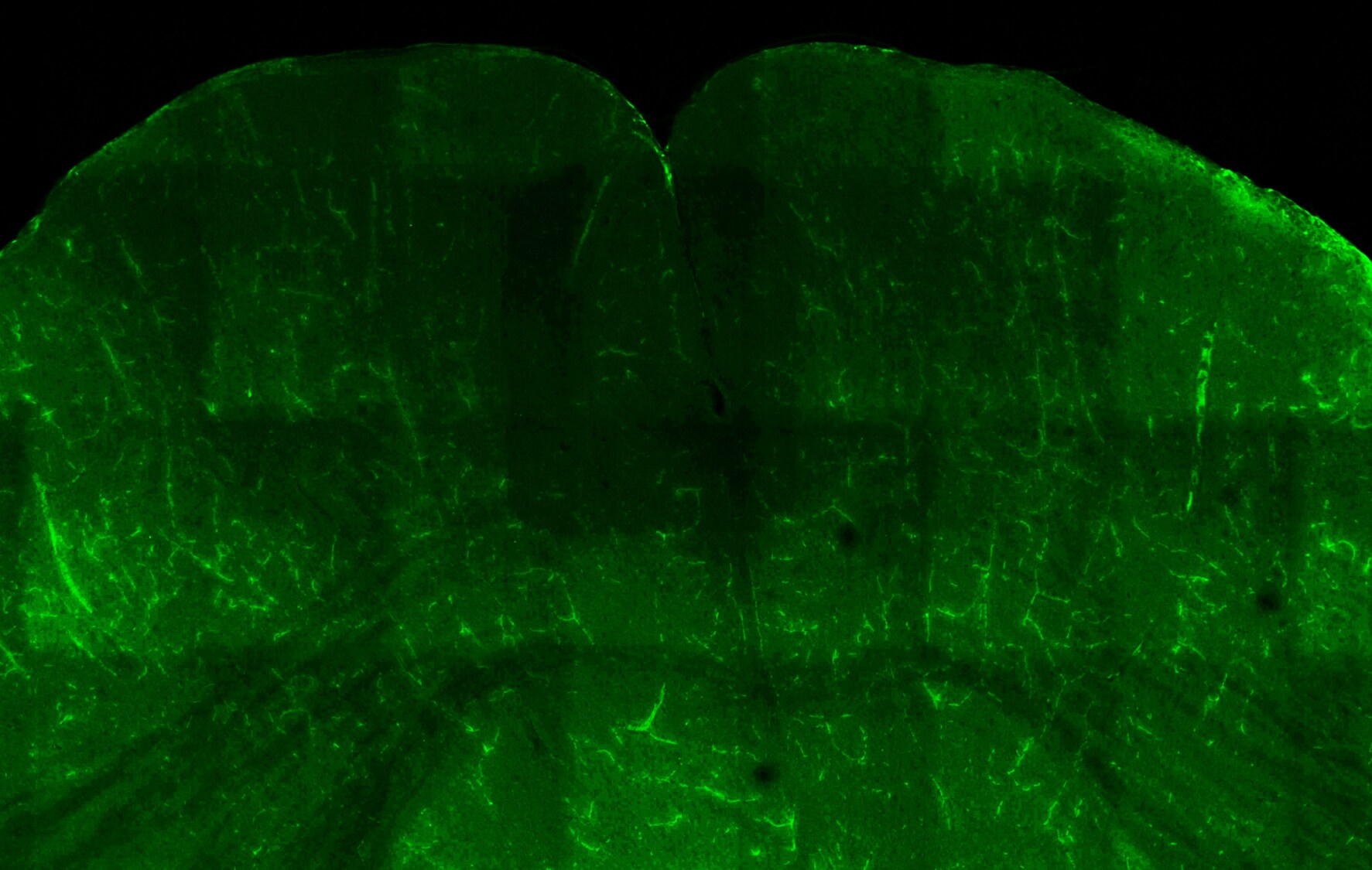 Acetylcholinesterase/ACHE Antibody NB100-1519