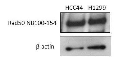 Rad50 Antibody - BSA Free NB100-154