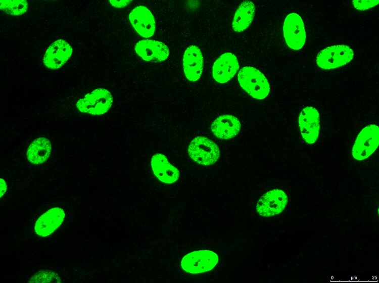 NONO Antibody NB100-1556