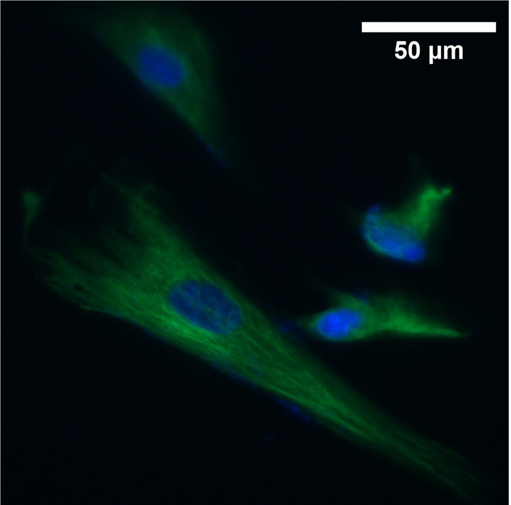 Nestin Antibody - BSA Free NB100-1604