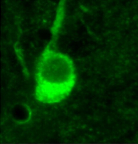 Nestin Antibody - BSA Free NB100-1604