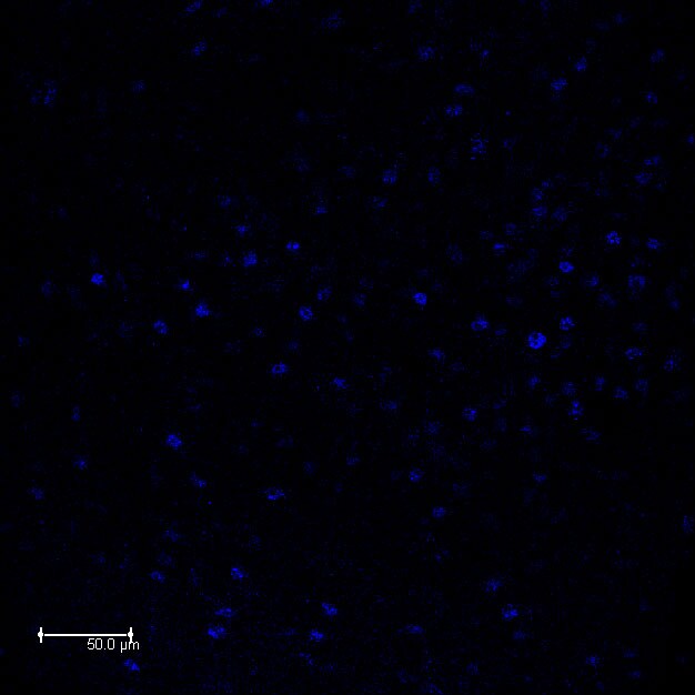 NCOA2 Antibody NB100-1756