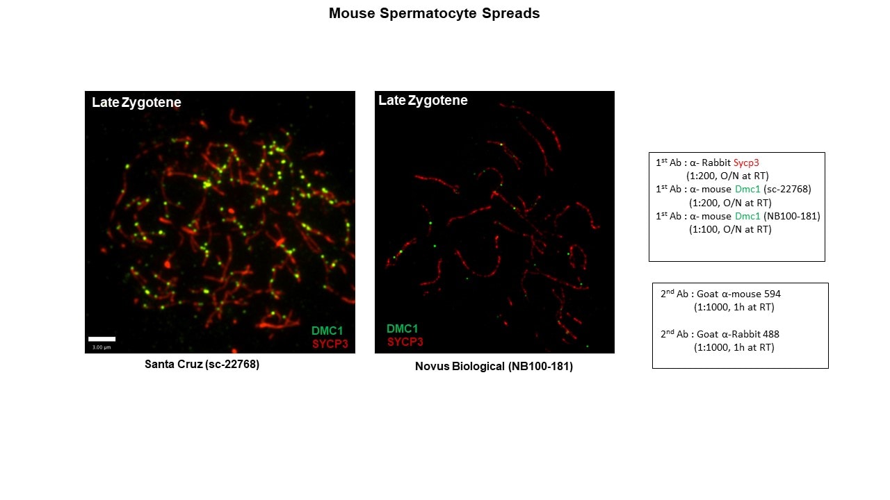 DMC1 Antibody (1D12/4) - BSA Free NB100-181