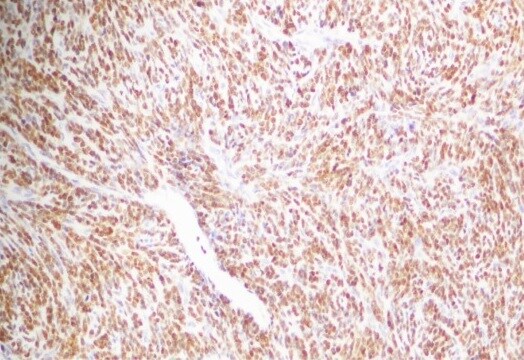 NKX3.1 Antibody (0361) - BSA Free NB100-1828
