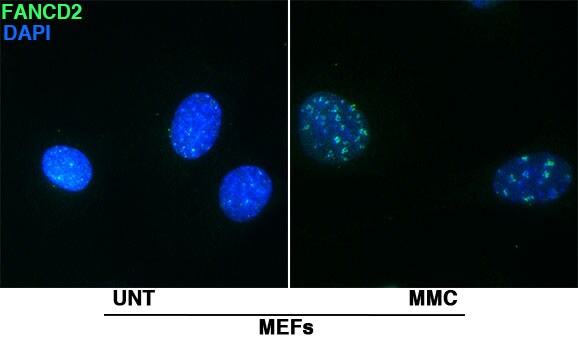 FANCD2 Antibody - BSA Free NB100-182
