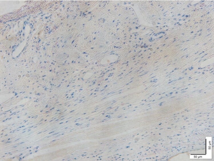 Fibroblast Surface Protein Antibody (1B10) NB100-1845