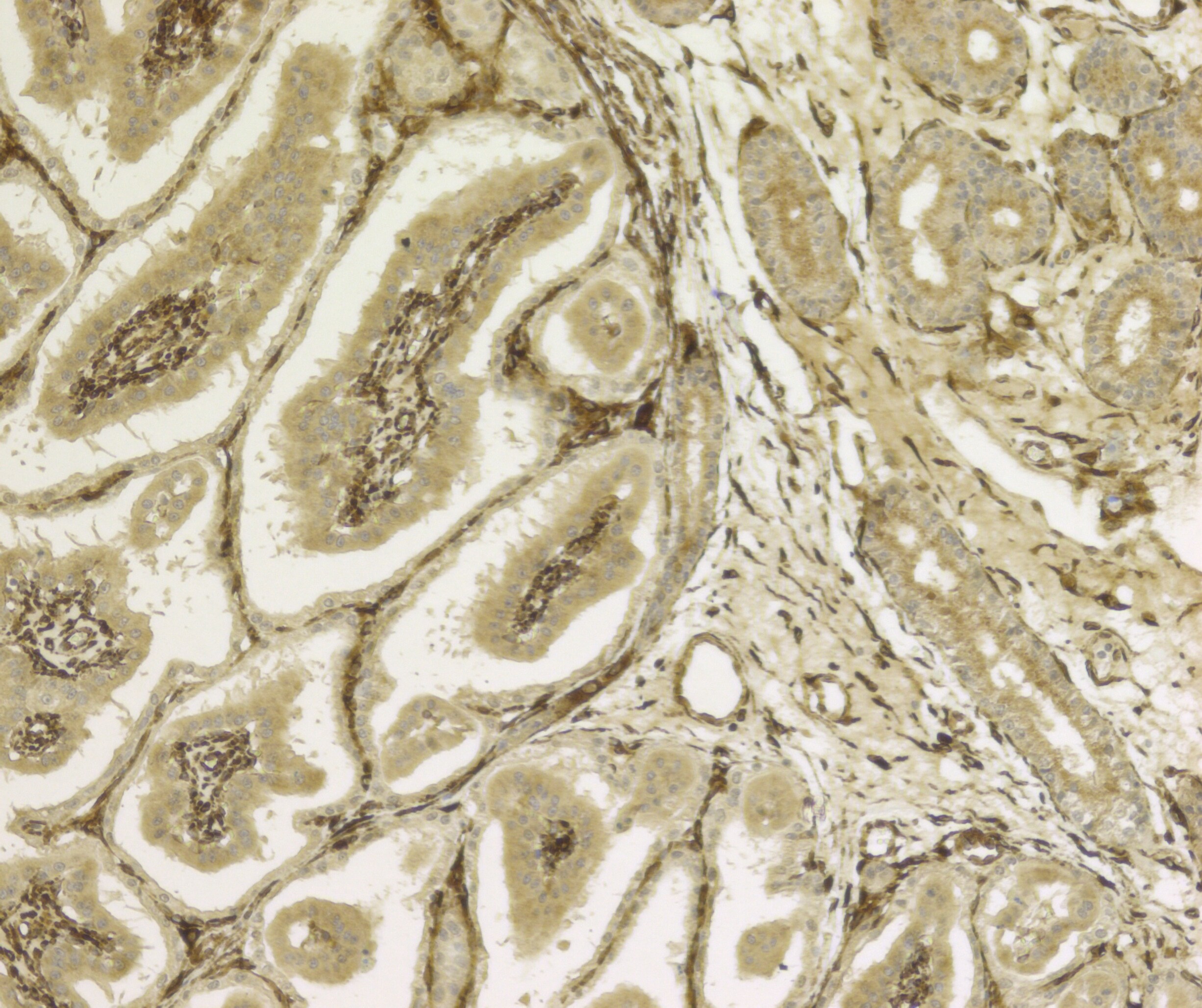 Furin Antibody NB100-1903