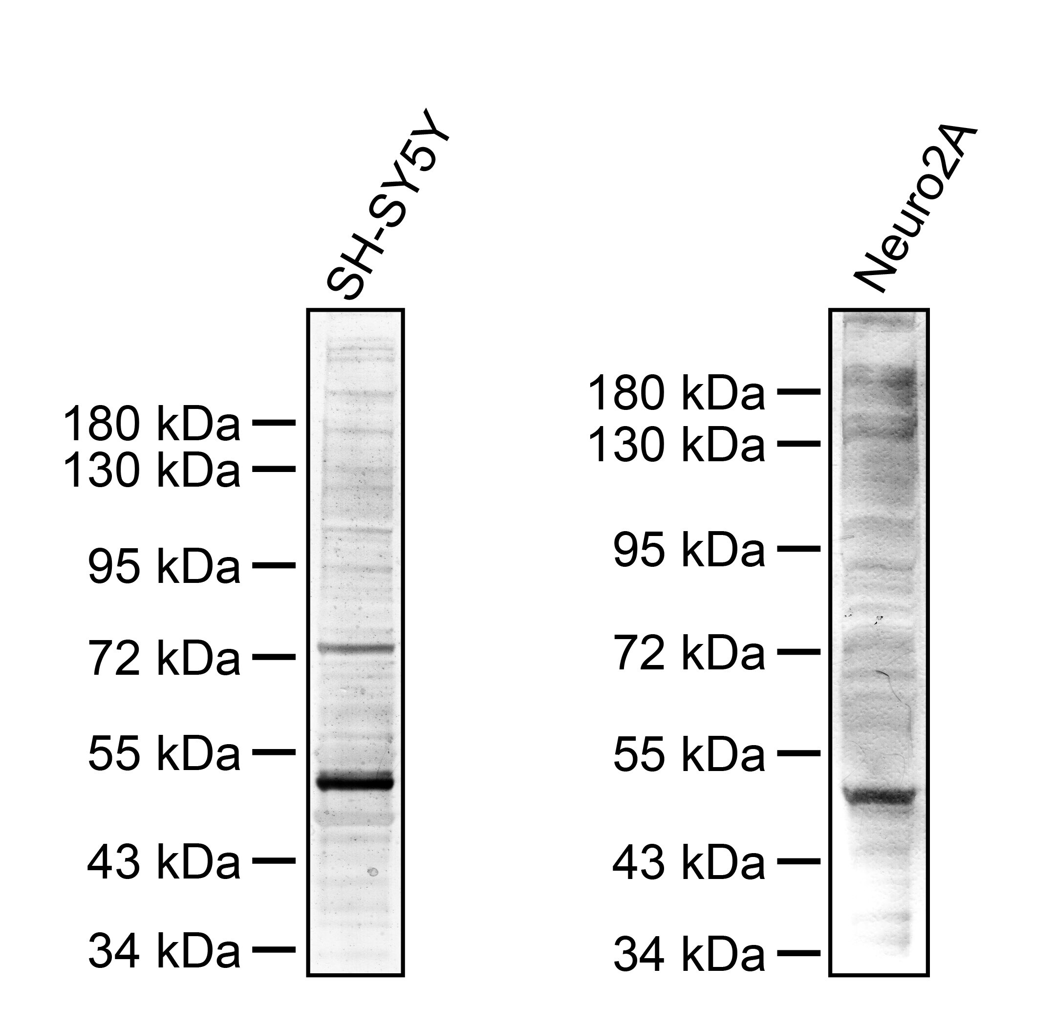 Phosphoserine Antibody - BSA Free NB100-1953