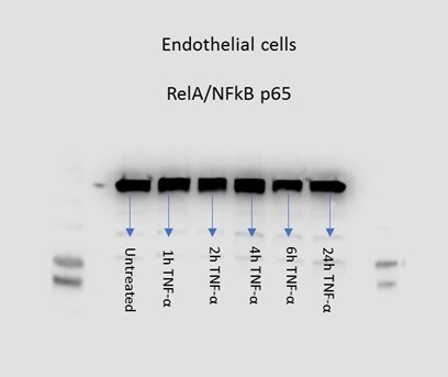 RelA/NFkB p65 Antibody - BSA Free NB100-2176