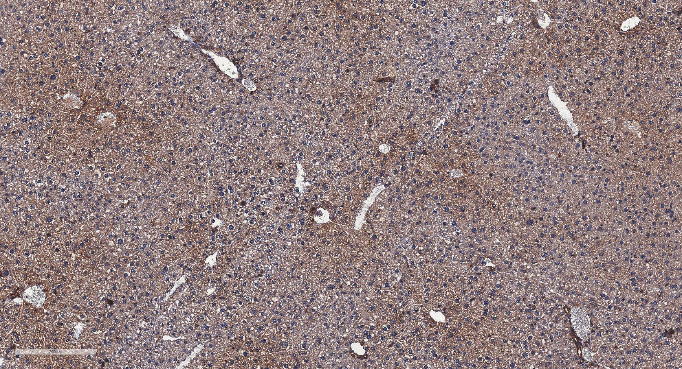 RelA/NFkB p65 Antibody - BSA Free NB100-2176
