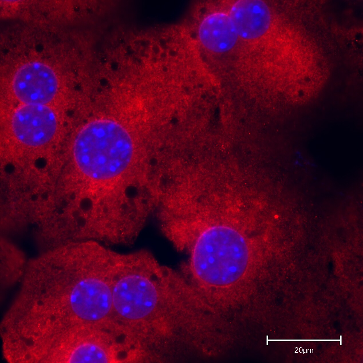 RelA/NFkB p65 Antibody - BSA Free NB100-2176