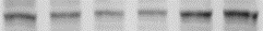SREBP1 Antibody - BSA Free NB100-2215