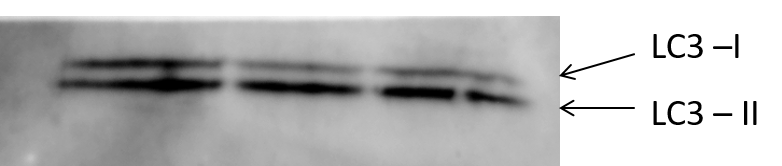 LC3B Antibody - BSA Free NB100-2220