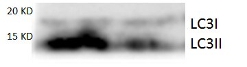 LC3B Antibody - BSA Free NB100-2220