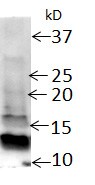 LC3B Antibody - BSA Free NB100-2220