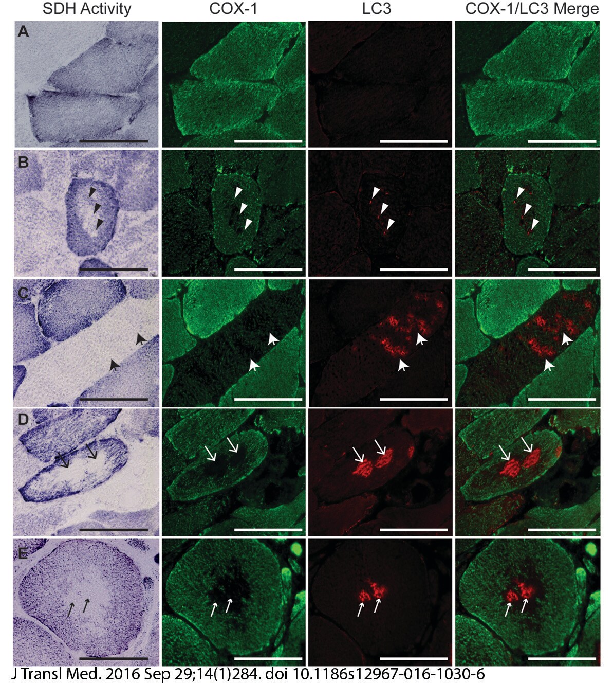 LC3B Antibody - BSA Free NB100-2220