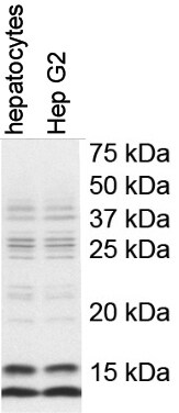 LC3B Antibody - BSA Free NB100-2220