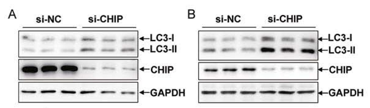 LC3B Antibody - BSA Free NB100-2220