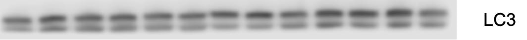 LC3B Antibody - BSA Free NB100-2220