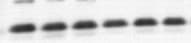 LC3B Antibody - BSA Free NB100-2220