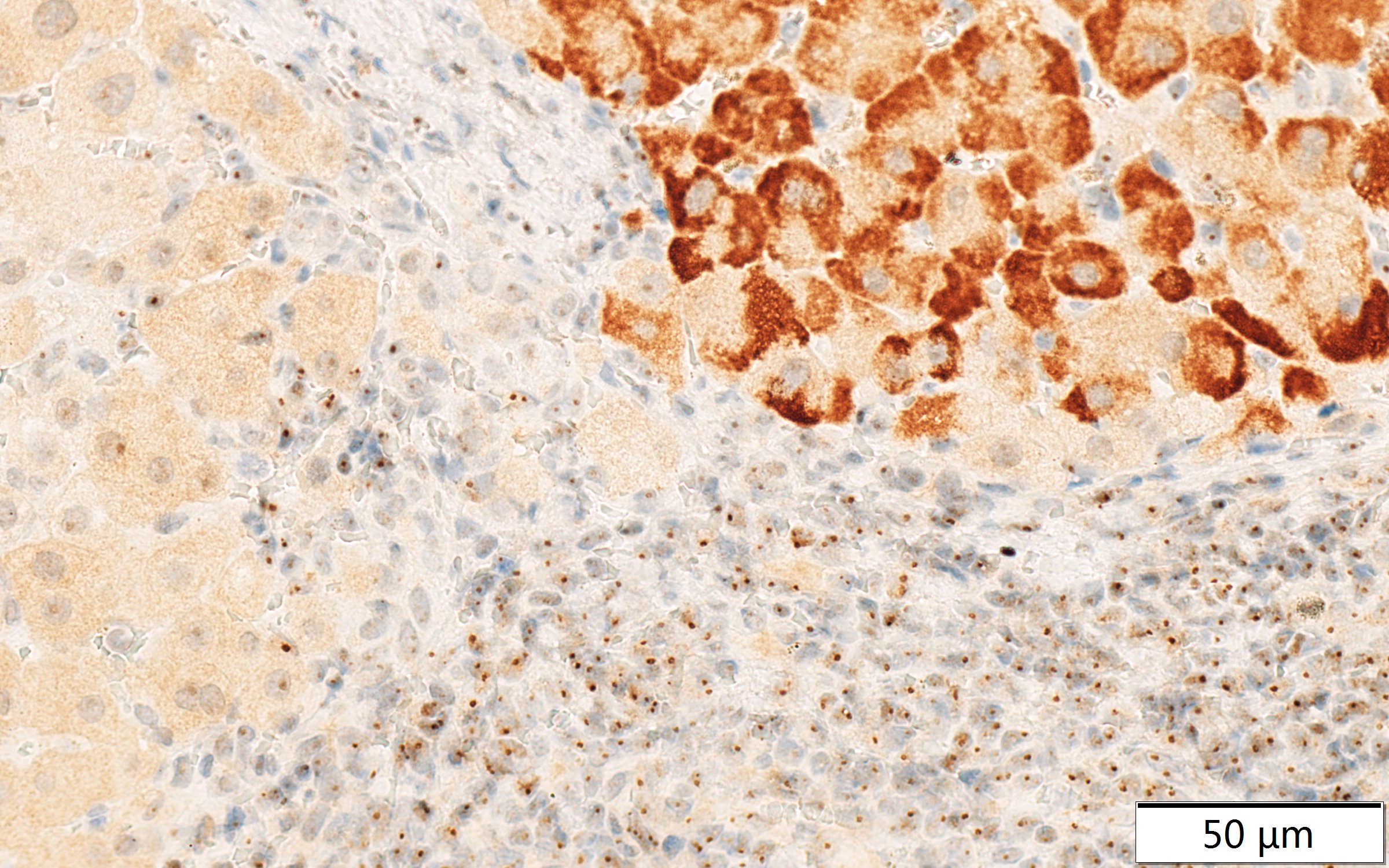 DDX24 Antibody NB100-2226