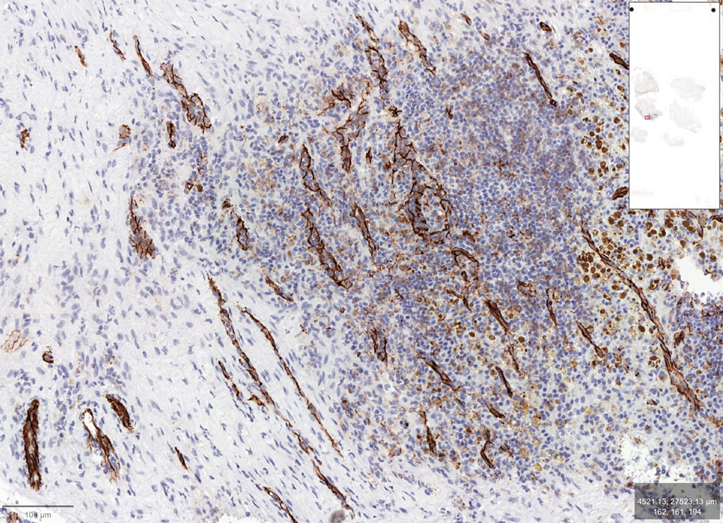 CD31/PECAM-1 Antibody NB100-2284